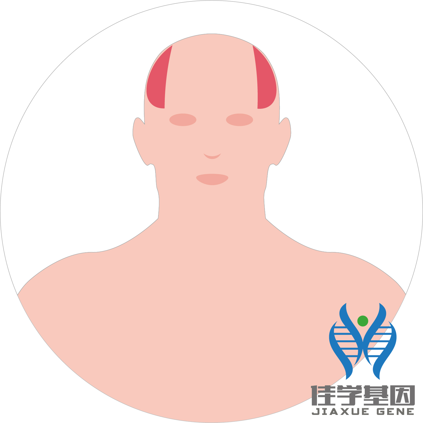 【佳學(xué)基因檢測】男性<font color='red'>脫發(fā)</font>（Androgenetic alopecia）基因解碼、<a href=http://www.lag888.cn/tk/jiema/cexujishu/2021/31933.html>基因檢測</a>