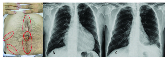 包含圖片、插圖等的外部文件。對象名稱為 turkjmedsci-50-1591-fig001.jpg